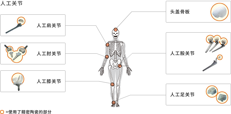 用途: 人工关节